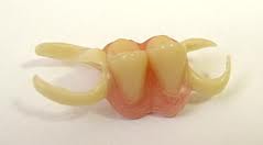 Photo: prothèse en silicone à 2 dents