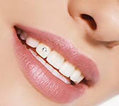 Photo: Skyce avec un diamant sur la dent