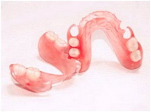 Photo: Nylon prostheses in the presence of terminal defects of teeth