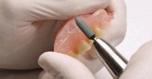 Foto: presentar una dentadura