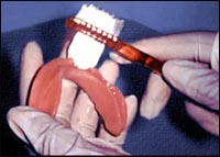 Foto: Periajul unei proteze