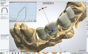 Foto: Tecnologia CAD / CAM