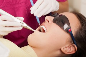 Foto: Torneamento dentário a laser