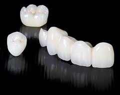Photo: Dental crowns