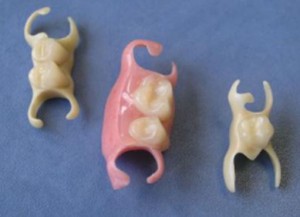 Photo: Butterfly removable dentures