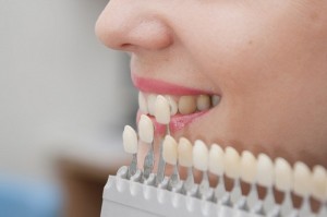 Foto: Skala för att välja färg på tänderna