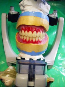 Foto: Indstilling af tænderne i artikulatoren