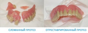 Fotoğraf: Onarım öncesi ve sonrası takma diş