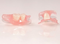 Gambar: gigi palsu untuk 1-2 gigi