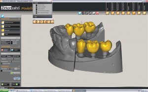 Photo: Production of a denture using CAD / CAM technology