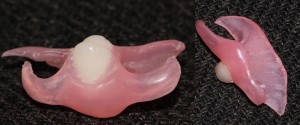 Foto: Nylon prothese voor één tand