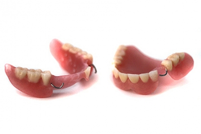 Foto: Dentaduras parciales laminares en ambas mandíbulas