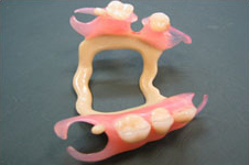 Kuva: Nailonproteesi puuttuvien hampaiden palauttamiseksi