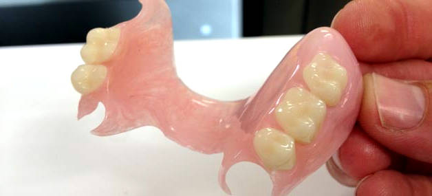Foto: Dentadura parcial de silicona
