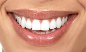 Foto: Tänder efter restaurering av fanér