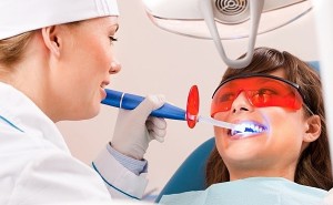 Foto: Blanqueamiento dental con láser