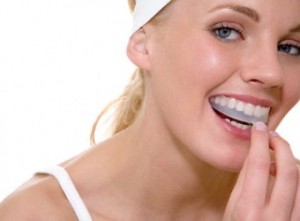 Photo: Teeth whitening with mouthguard